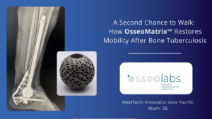 osseolabs patient story graphic